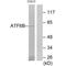 Activating Transcription Factor 6 Beta antibody, A08395, Boster Biological Technology, Western Blot image 