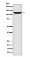 Protein Kinase N2 antibody, M04066, Boster Biological Technology, Western Blot image 