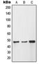 Matrix Metallopeptidase 12 antibody, LS-C352531, Lifespan Biosciences, Western Blot image 