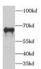 Glutamate decarboxylase 1 antibody, FNab09843, FineTest, Western Blot image 