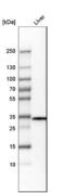 Thiosulfate Sulfurtransferase antibody, NBP1-87148, Novus Biologicals, Western Blot image 