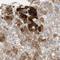 Farnesyl-Diphosphate Farnesyltransferase 1 antibody, HPA008874, Atlas Antibodies, Immunohistochemistry paraffin image 