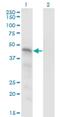 Sorting Nexin 15 antibody, H00029907-M01, Novus Biologicals, Western Blot image 