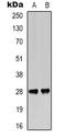 TAG-72 antibody, orb388038, Biorbyt, Western Blot image 