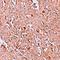 F-Box And Leucine Rich Repeat Protein 16 antibody, orb75560, Biorbyt, Immunohistochemistry paraffin image 