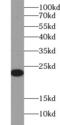 CD3 antibody, FNab01458, FineTest, Western Blot image 