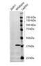 Isocitrate Dehydrogenase (NADP(+)) 1, Cytosolic antibody, orb22508, Biorbyt, Western Blot image 
