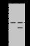 TRNA Splicing Endonuclease Subunit 34 antibody, 203456-T32, Sino Biological, Western Blot image 