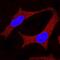 Superoxide Dismutase 1 antibody, MAB3418, R&D Systems, Immunocytochemistry image 