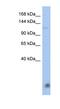 HECT And RLD Domain Containing E3 Ubiquitin Protein Ligase 5 antibody, NBP1-58101, Novus Biologicals, Western Blot image 