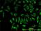 Mitochondrial import receptor subunit TOM20 homolog antibody, H00009804-M01, Novus Biologicals, Immunofluorescence image 