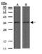 Protein Phosphatase 4 Catalytic Subunit antibody, GTX108299, GeneTex, Western Blot image 