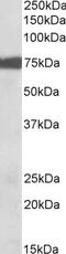 CREB Regulated Transcription Coactivator 2 antibody, 42-852, ProSci, Western Blot image 