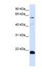 Chromosome 14 Open Reading Frame 180 antibody, NBP1-59680, Novus Biologicals, Western Blot image 