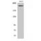 Neurofibromin 1 antibody, LS-C384834, Lifespan Biosciences, Western Blot image 