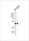 MOS Proto-Oncogene, Serine/Threonine Kinase antibody, LS-C164489, Lifespan Biosciences, Western Blot image 