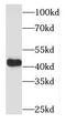 OFD1 Centriole And Centriolar Satellite Protein antibody, FNab05975, FineTest, Western Blot image 