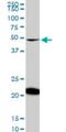 NAD Kinase antibody, H00065220-M01, Novus Biologicals, Western Blot image 