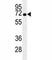 Heat shock 70 kDa protein 1A/1B antibody, F40246-0.4ML, NSJ Bioreagents, Western Blot image 