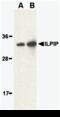 STE20 Related Adaptor Beta antibody, 3199, ProSci, Western Blot image 