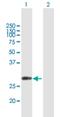 CutC Copper Transporter antibody, H00051076-B01P, Novus Biologicals, Western Blot image 