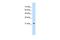 Progesterone Receptor Membrane Component 1 antibody, PA5-42919, Invitrogen Antibodies, Western Blot image 