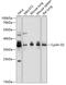 Cyclin D2 antibody, 18-075, ProSci, Western Blot image 