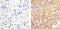 Zeta Chain Of T Cell Receptor Associated Protein Kinase 70 antibody, 44-230G, Invitrogen Antibodies, Immunohistochemistry paraffin image 