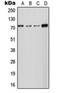 Solute Carrier Family 24 Member 2 antibody, orb215100, Biorbyt, Western Blot image 