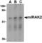 Interleukin-1 receptor-associated kinase-like 2 antibody, LS-B3201, Lifespan Biosciences, Western Blot image 