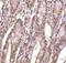 Acidic Nuclear Phosphoprotein 32 Family Member E antibody, NBP1-77227, Novus Biologicals, Immunohistochemistry paraffin image 