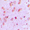 Keratin 13 antibody, LS-C352432, Lifespan Biosciences, Immunohistochemistry paraffin image 