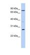 Kruppel Like Factor 12 antibody, NBP1-80010, Novus Biologicals, Western Blot image 