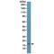 Cyclin-dependent kinase inhibitor 2A, isoforms 1/2/3 antibody, M00016-1, Boster Biological Technology, Western Blot image 