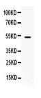 Annexin A7 antibody, A04889, Boster Biological Technology, Western Blot image 