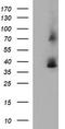 Secretory Carrier Membrane Protein 2 antibody, LS-C338312, Lifespan Biosciences, Western Blot image 