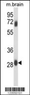 Fc Fragment Of IgG Receptor IIc (Gene/Pseudogene) antibody, 63-734, ProSci, Western Blot image 
