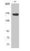 ATP Binding Cassette Subfamily C Member 12 antibody, STJ91412, St John