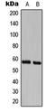 CDK5 Regulatory Subunit Associated Protein 3 antibody, LS-C354203, Lifespan Biosciences, Western Blot image 