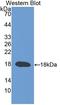 Transient Receptor Potential Cation Channel Subfamily V Member 3 antibody, LS-C373414, Lifespan Biosciences, Western Blot image 