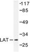 Linker For Activation Of T Cells antibody, LS-C176422, Lifespan Biosciences, Western Blot image 