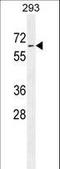 Phospholipase D Family Member 5 antibody, LS-C163784, Lifespan Biosciences, Western Blot image 