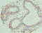 Pyridoxal Kinase antibody, LS-C676240, Lifespan Biosciences, Immunohistochemistry paraffin image 