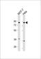 Fibroblast Growth Factor Receptor Substrate 2 antibody, 60-155, ProSci, Western Blot image 