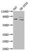 TCDD Inducible Poly(ADP-Ribose) Polymerase antibody, CSB-PA801800LA01HU, Cusabio, Western Blot image 