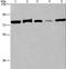 Activin A Receptor Type 2A antibody, LS-C402149, Lifespan Biosciences, Western Blot image 