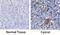 Leucine Rich Repeats And Immunoglobulin Like Domains 3 antibody, AF3495, R&D Systems, Western Blot image 