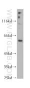 Twinkle protein, mitochondrial antibody, 18793-1-AP, Proteintech Group, Western Blot image 