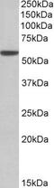 Aldehyde Dehydrogenase 3 Family Member A1 antibody, PA5-19326, Invitrogen Antibodies, Western Blot image 