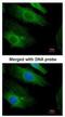 HRas Proto-Oncogene, GTPase antibody, NBP2-42864, Novus Biologicals, Immunocytochemistry image 